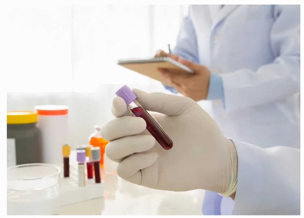 血常规检查各项指标都高什么原因,血常规检查3项高有什么病