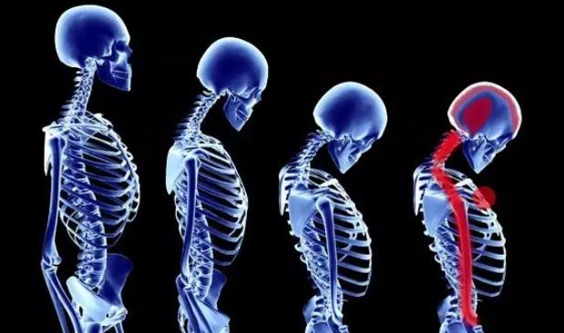 痛、痛、痛，冬季颈部受凉导致疼痛应该怎么办？