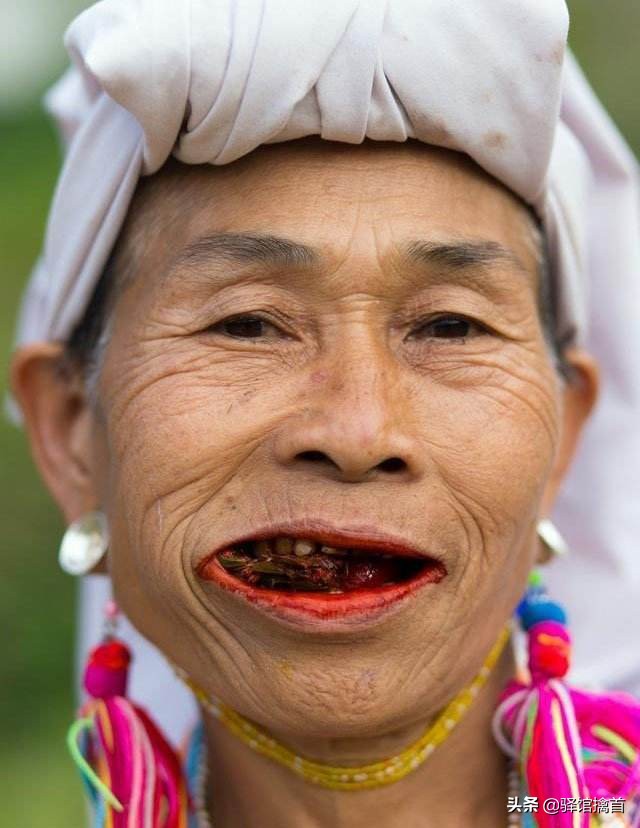 槟榔成瘾为啥不戒掉槟榔,槟榔的危害真实事例