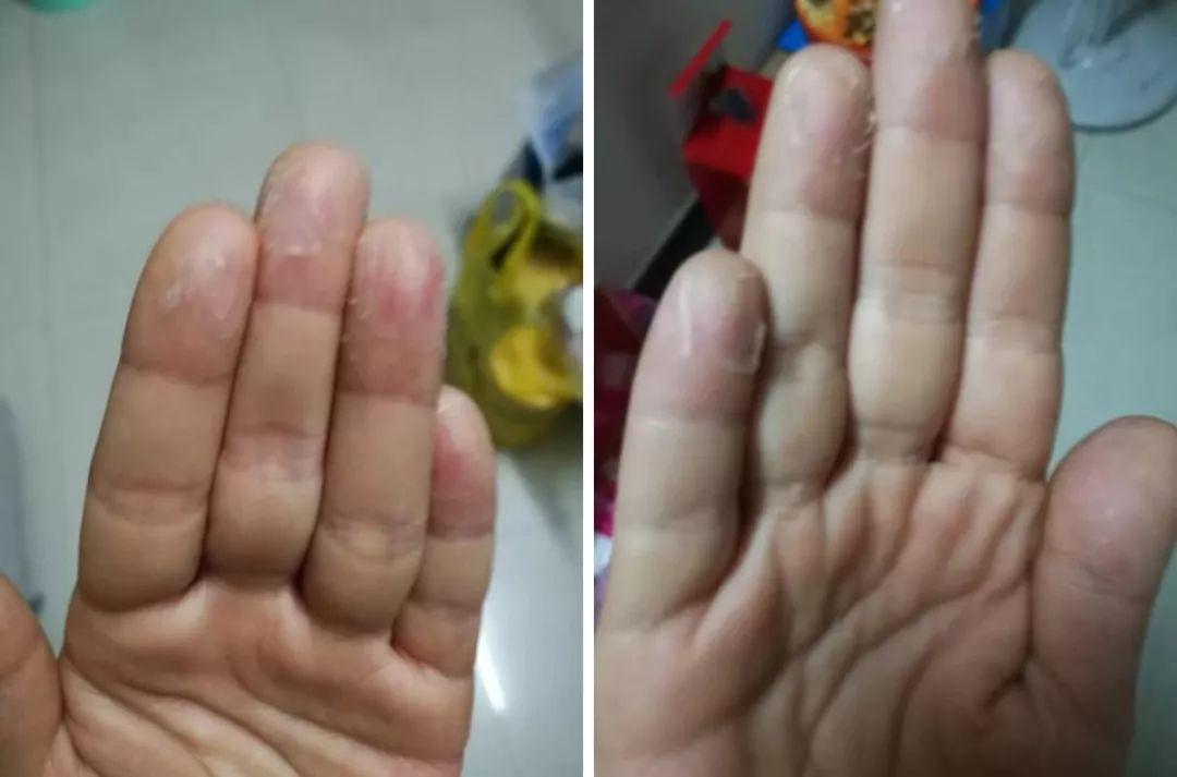 如何看懂孩子疫苗本,如何看懂孩子和自己的情绪