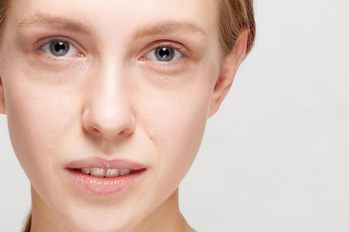 色素黑眼圈怎么去除,熬夜黑眼圈怎么去除