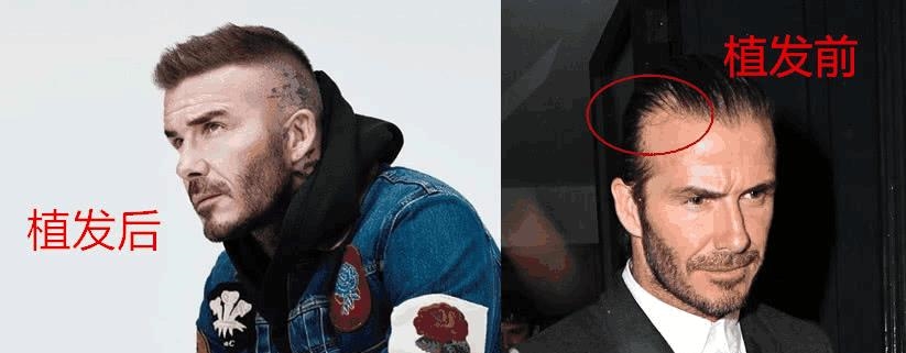 贝克汉姆回应假发,贝克汉姆事件辟谣