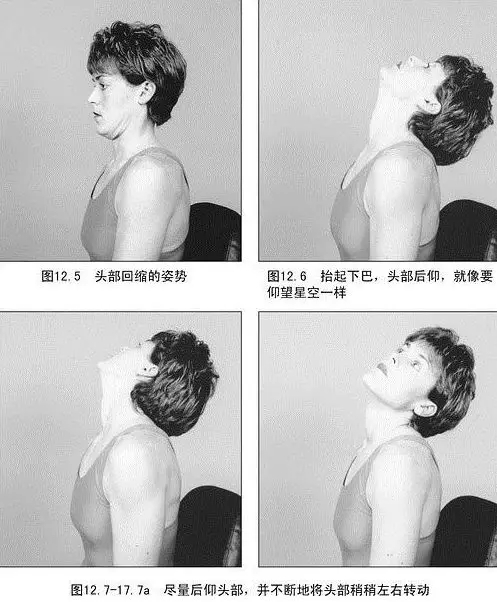 麦肯基疗法治颈椎全套视频,麦肯基治疗神经根型颈椎病