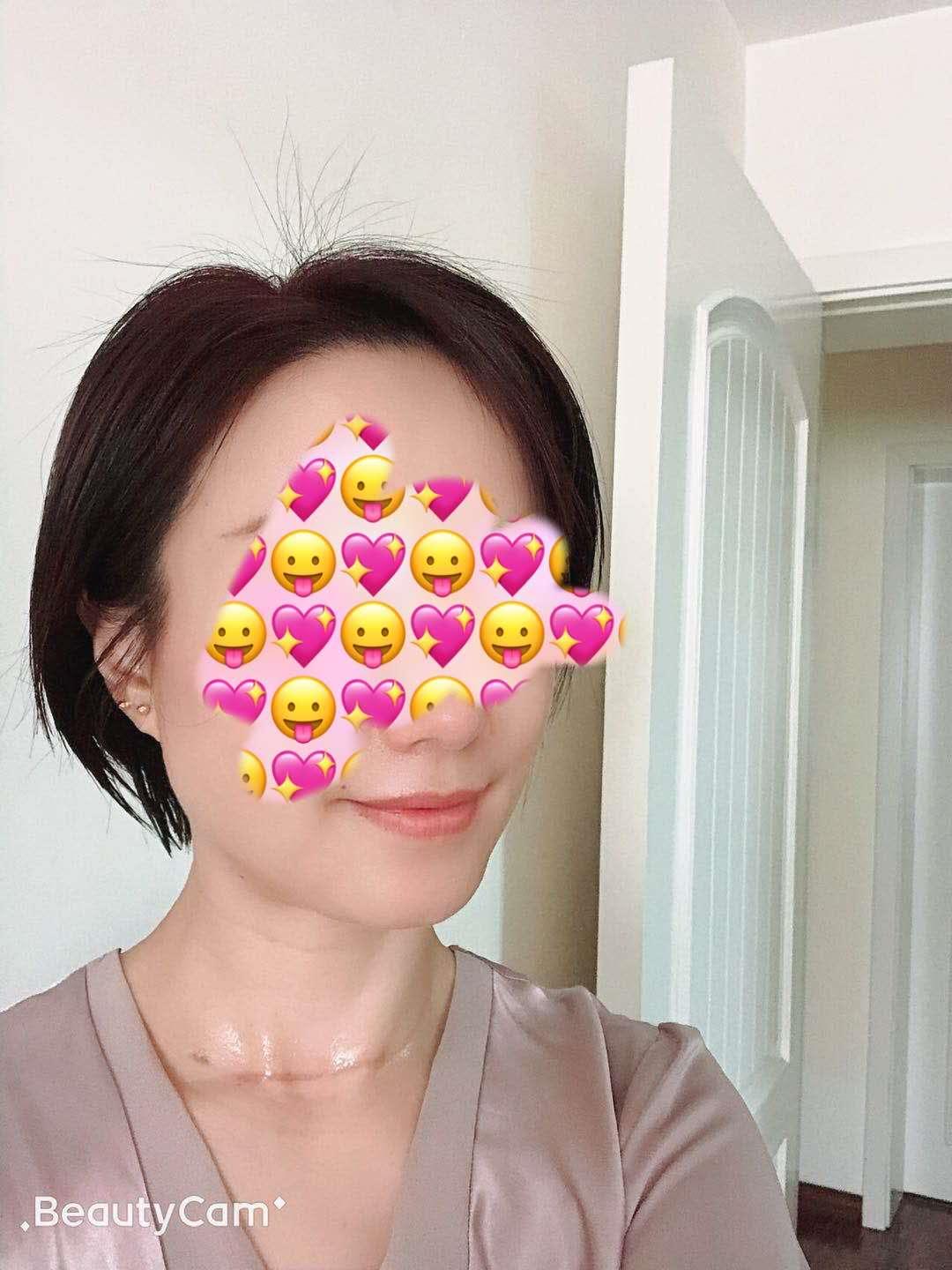 教师容易得甲状腺病吗,甲状腺是老师的职业病吗