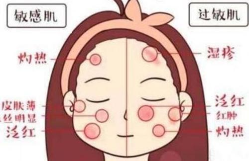 过度敏感如何改善吃什么药,清洁过度导致的敏感肌怎么办