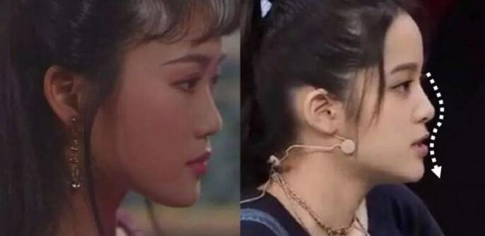 面部一枝花全靠鼻当家，论鼻子对颜值的重要性▼