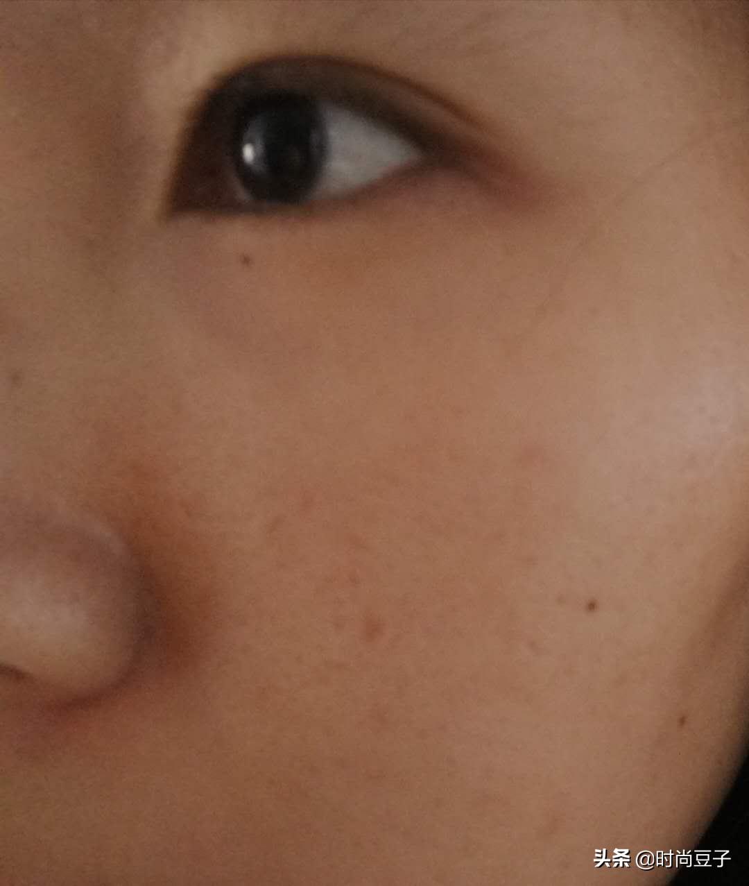 痘肌混油皮适合的补水喷雾,适合油痘肌的四大神水