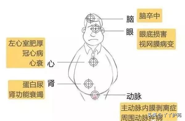 高血压并发症用药,高血压并发症应对处理小视频