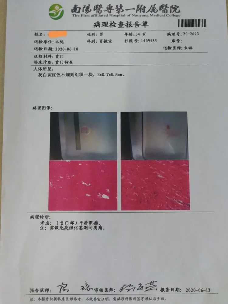 贲门隆起性病变影像,贲门溃疡隆起性病变