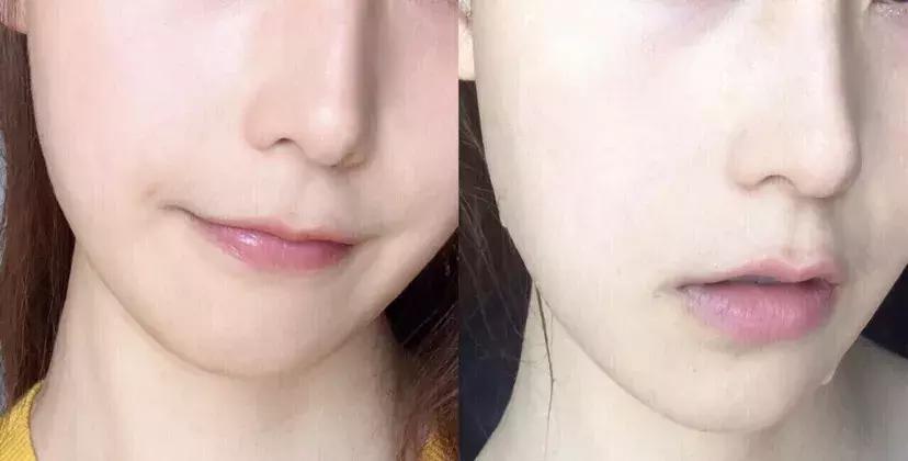 日本这个赛过美白针的王牌内服，让贵妇POLA、SK-II靠边站！