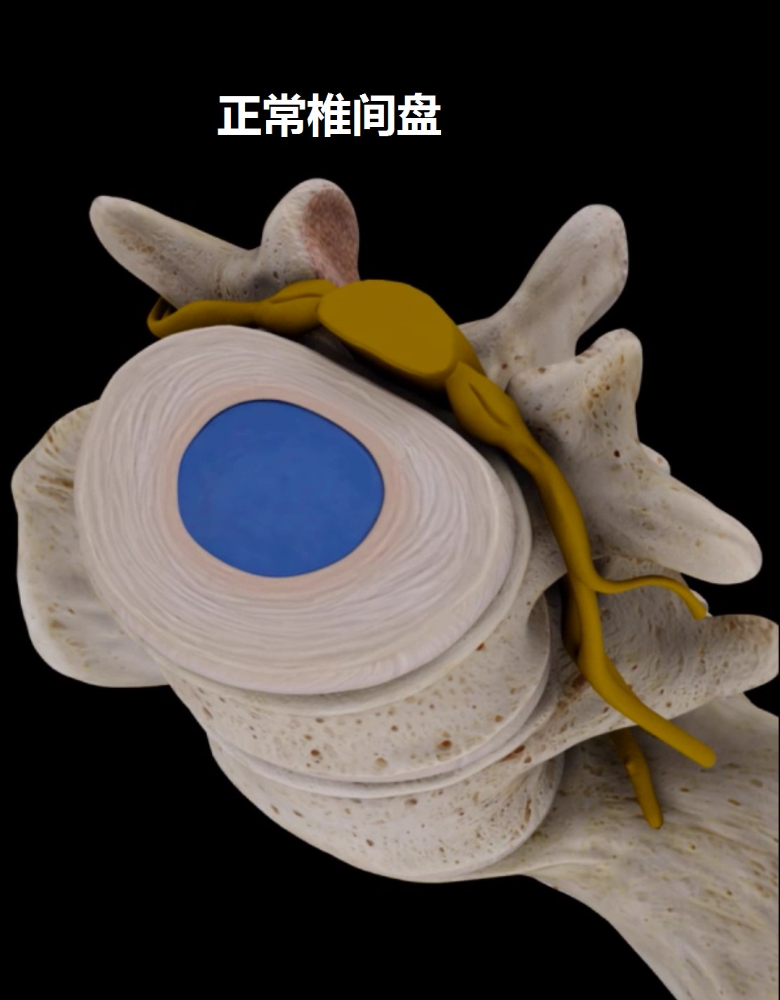 介绍一下治腰痛小窍门,不同腰痛的诊断与治疗