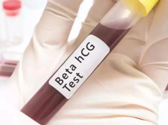 移植后打了hcg针后几天验孕准确,试管移植后要躺几天可以验孕