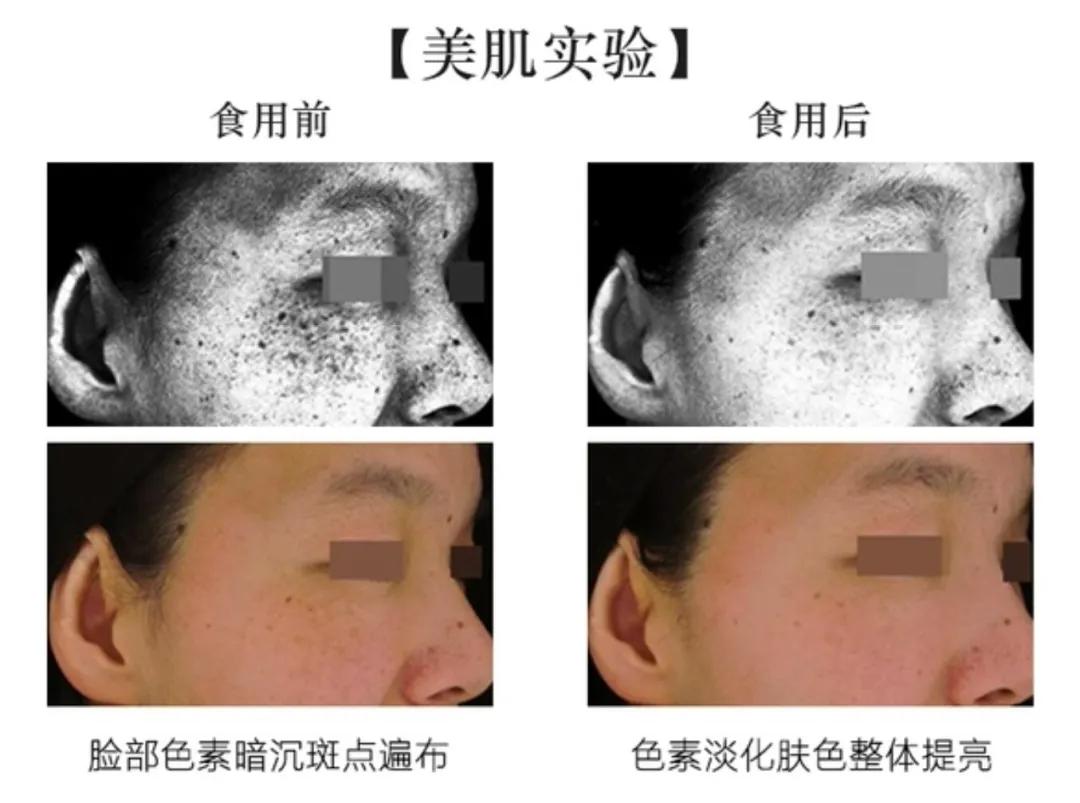 夏天怎么让自己白到发亮,如何在夏天白得发亮