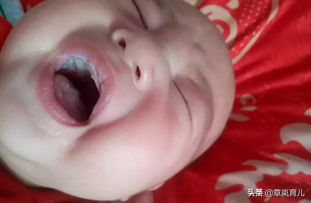宝宝会口臭吗,宝宝口臭是生病了吗