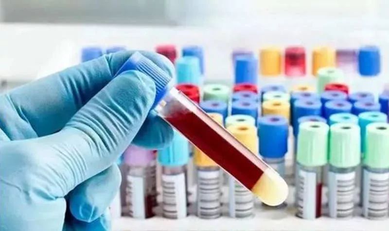 癌胚抗原升高，一定是患癌了吗？升高多少与病情严重程度有关系吗