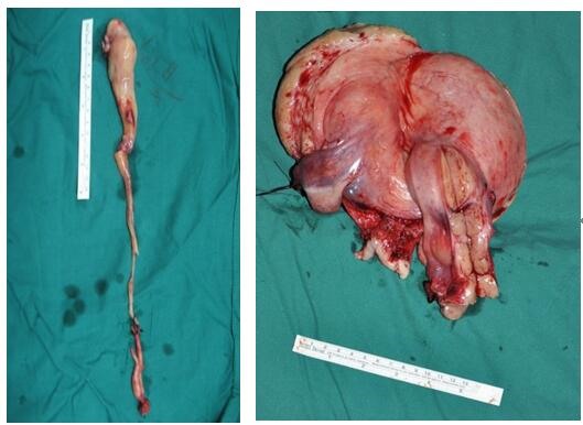 协和医院妇科肿瘤顶级专家电话,北京协和妇科肿瘤顶级专家