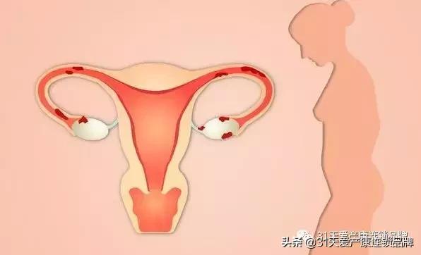 子宫最害怕的四种食物,子宫害怕的4件事