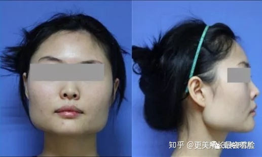 好看的侧脸要符合哪些条件,好看的侧脸的标准