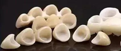 琚墮鍖诲拷鎮犲仛浜嗗叏鐡风墮瀵艰嚧鍢村嚫,鎻鐗欏尰璇寸殑鍏ㄧ摲鐗欏埌搴曟湁澶氬ソ