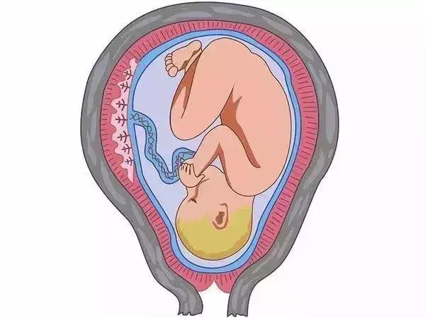 孕期耻骨分离痛是什么原因,孕期一侧耻骨疼怎么缓解