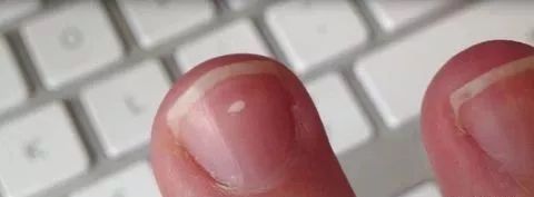 娃指甲上有白点是怎么回事,孩子指甲横纹有白点