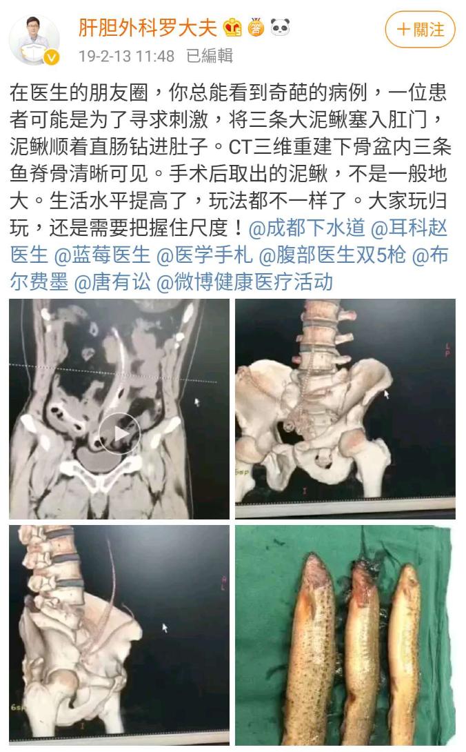 罗非鱼塞进直肠多长时间,星医百可以长期吃吗