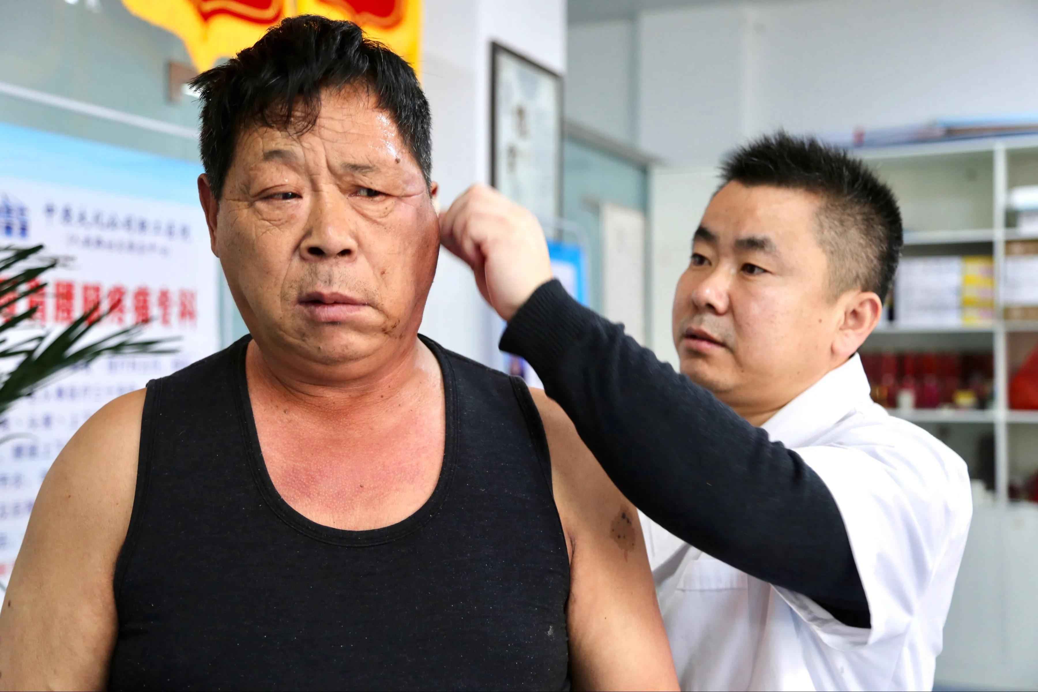 中医传承国医大师,中医古法经络神奇疗法