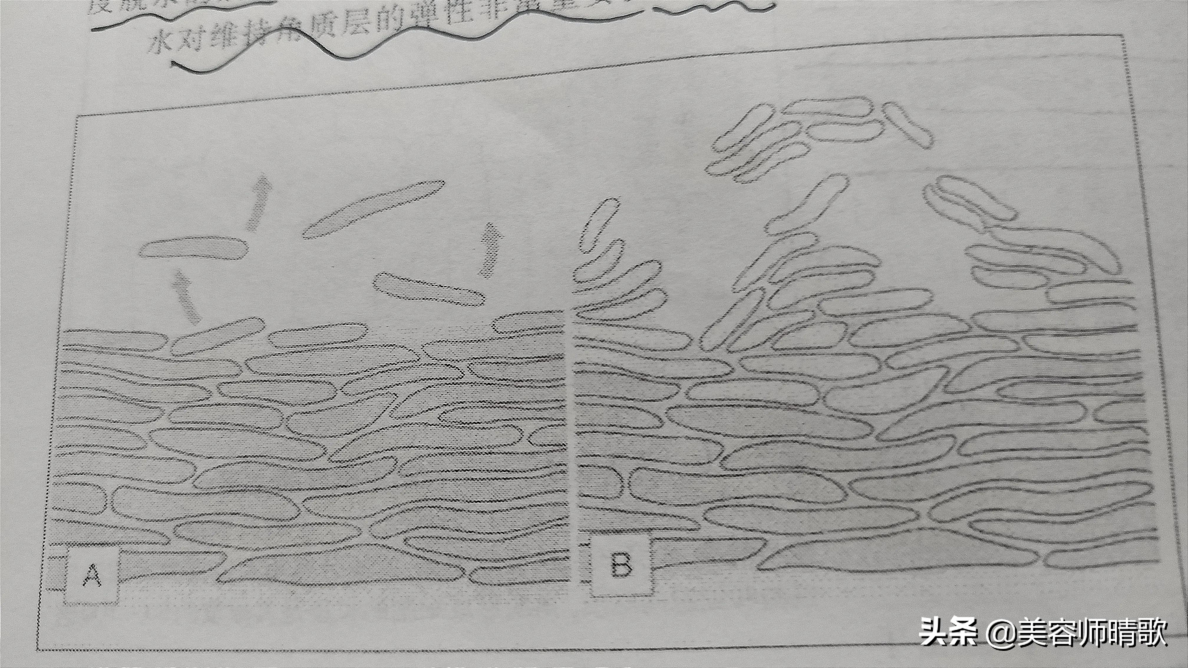 补水会破坏皮肤屏障吗,皮肤干燥用什么补水保湿效果最好