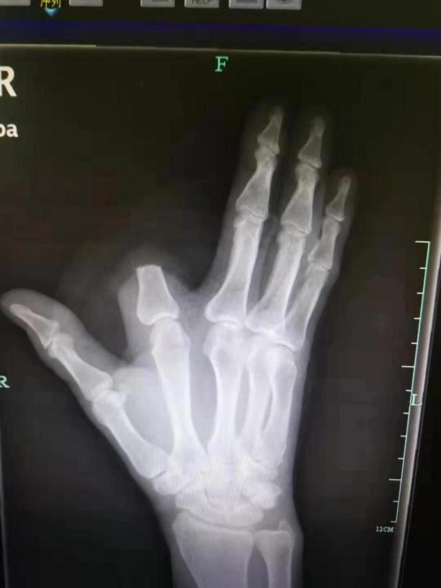 家里进蛇怎么办蛇怕什么,家里连续进了5次蛇