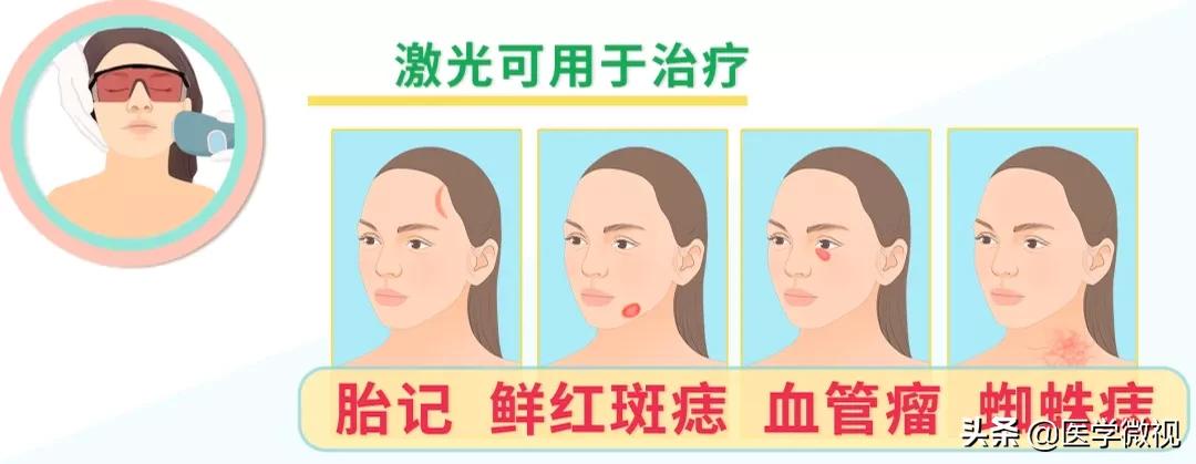 猕猴桃女孩腋下脱毛,猕猴桃女孩轻松脱毛的救星