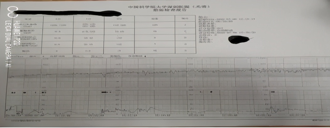 胎儿窘迫个案分享课件,胎儿窘迫案例分析题