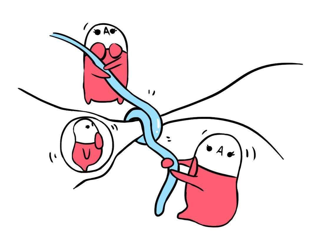 上环会出现宫外孕吗,上环之后炎症重容易宫外孕吗