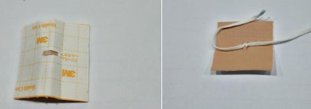 尿管固定别小看5cm，却是“血”的差距