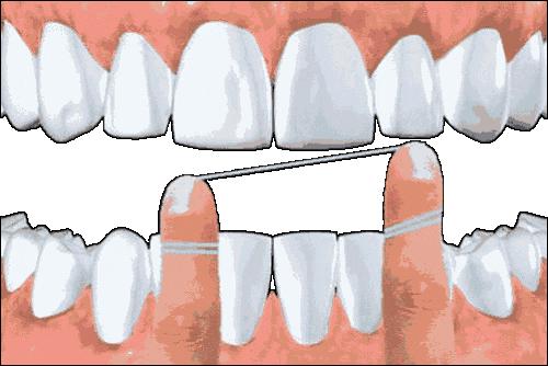 牙龈出血牙齿松动怎么解决,牙龈松动出血是什么原因引起的