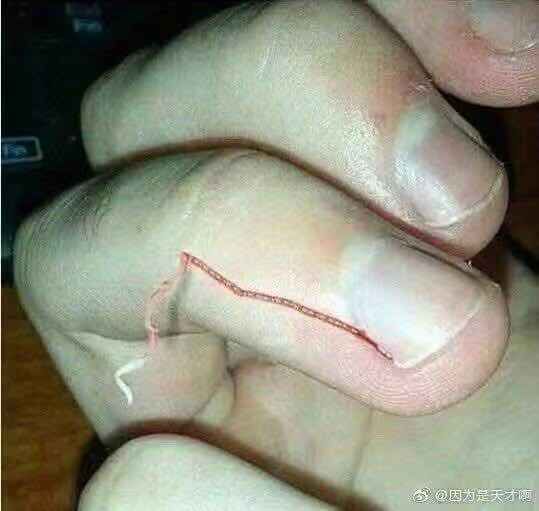 人体最痛的事情,生理上最痛的一次