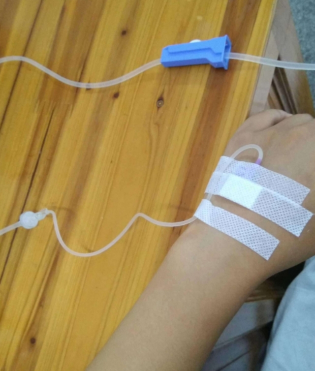 这几点剖腹产注意事项，希望可以帮您解决疑惑