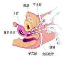 这些妇科检查您做过吗？