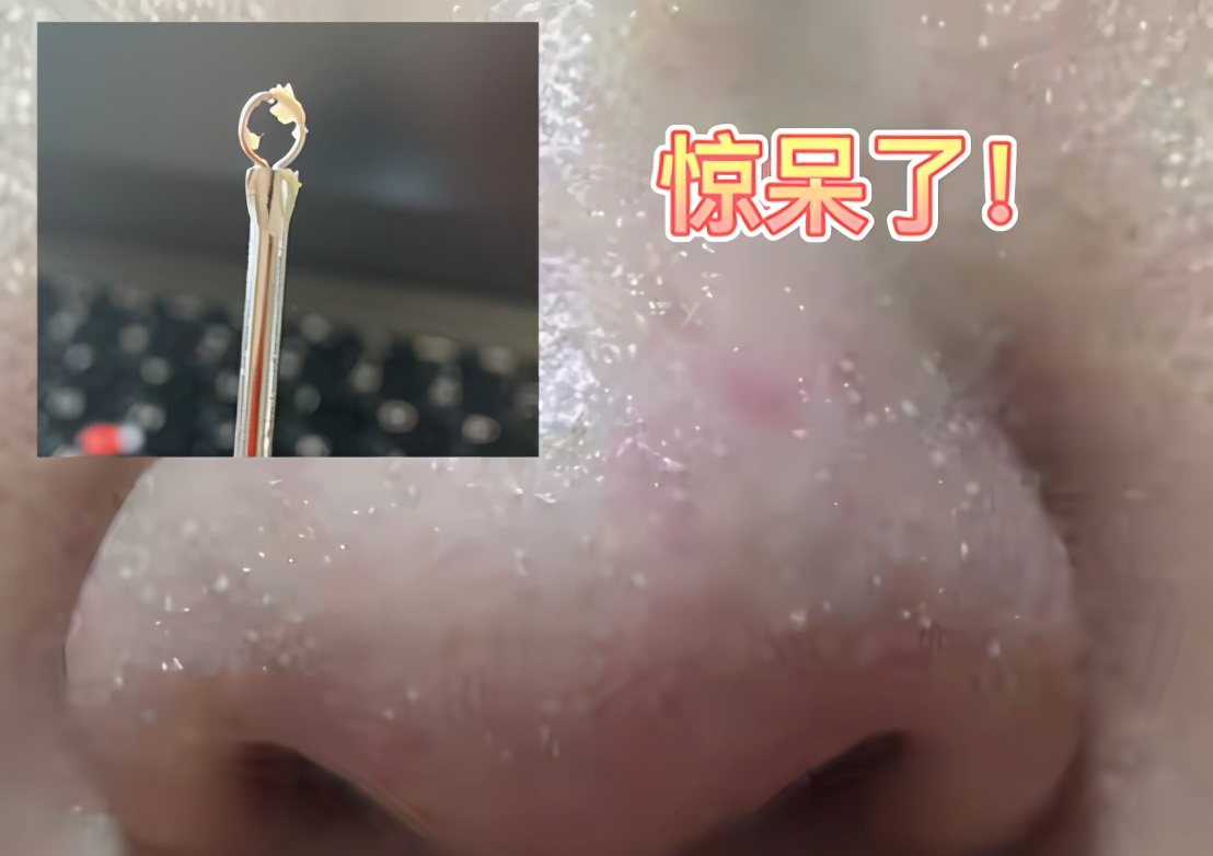 给男朋友第一次用黑头仪，皮肤居然这么脏，用完直呼：陈冠希