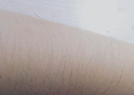 王大妈儿媳妇花了1W脱毛后才明白,千万不要轻易去脱毛