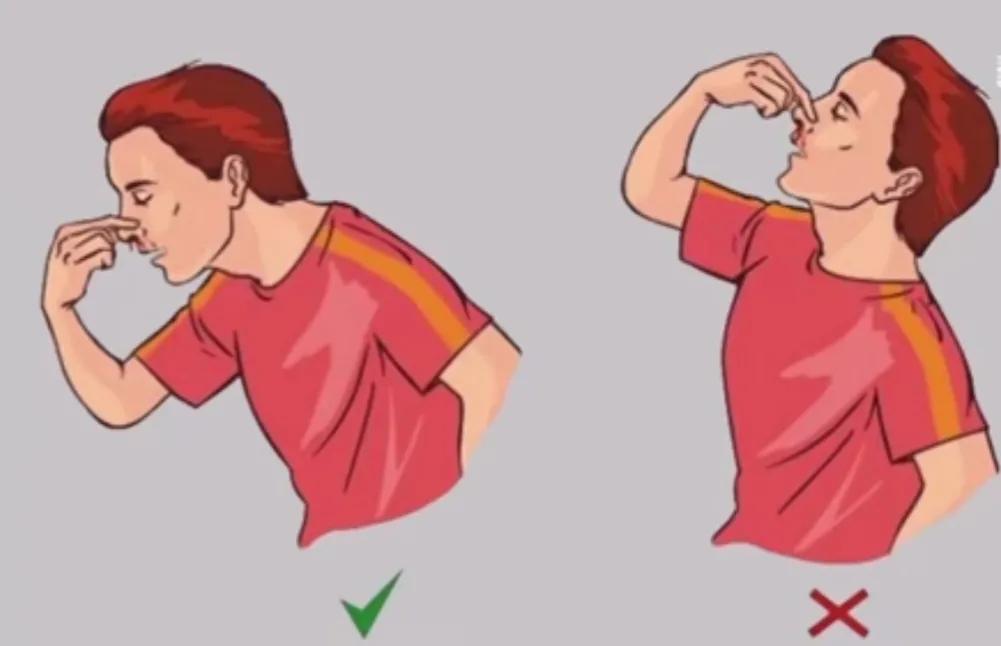 鼻子流血是好事吗,鼻子流血多了有危险吗