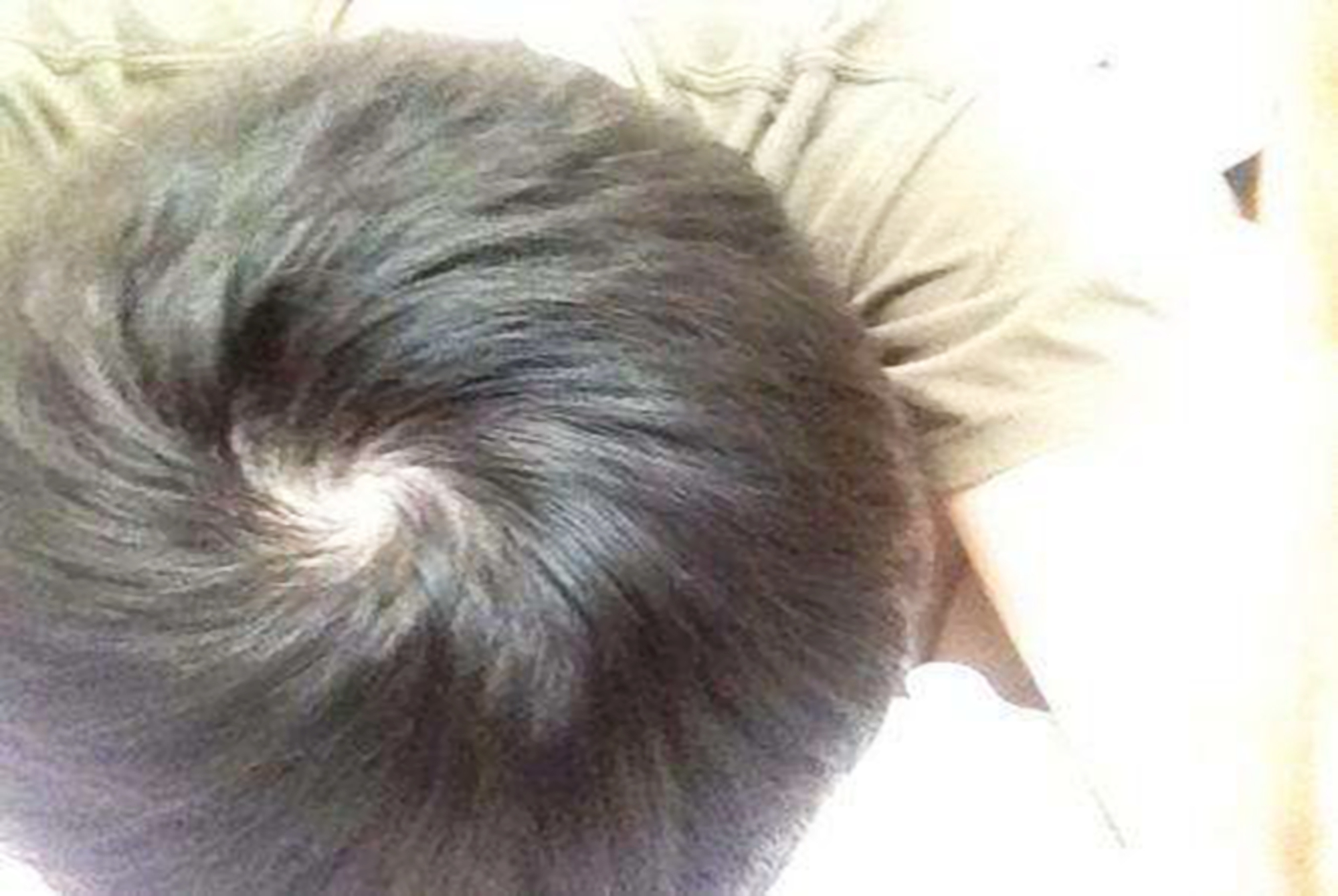 孩子头旋是逆时针智商低吗,宝宝的头旋偏右