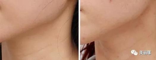 屈臣氏兰蔻粉水多少钱,屈臣氏兰蔻粉水是正品吗