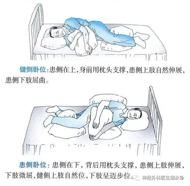 脑出血后肢体功能障碍还能恢复吗,脑出血后能恢复做饭功能吗