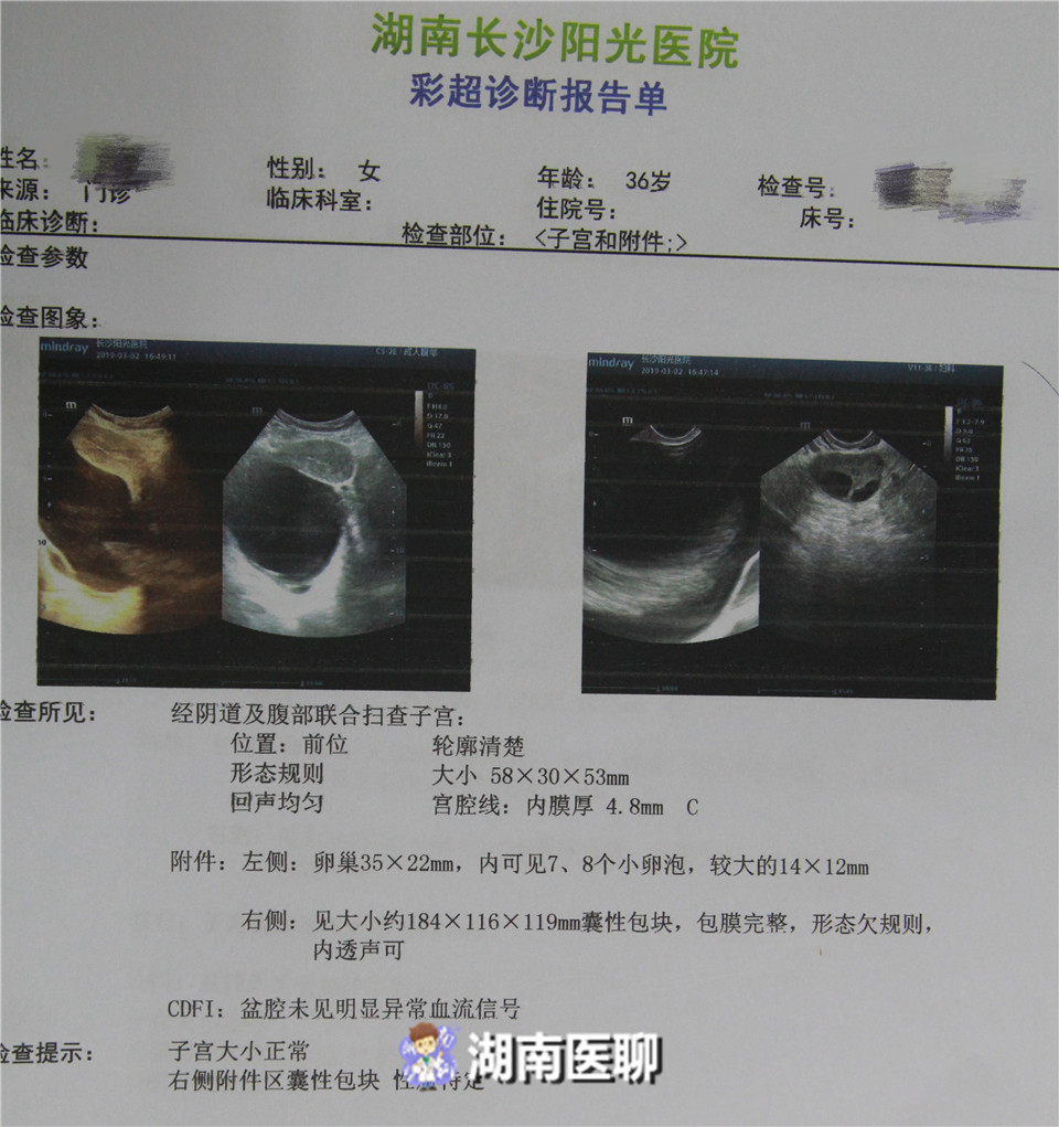 女子备孕2年未能怀上,备孕一年未成功的女人