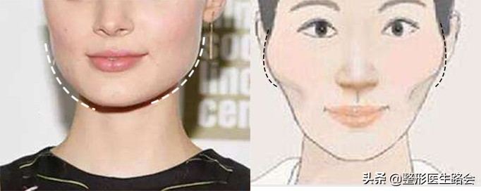 为什么你的脸越来越大,为什么你的脸会忽大忽小