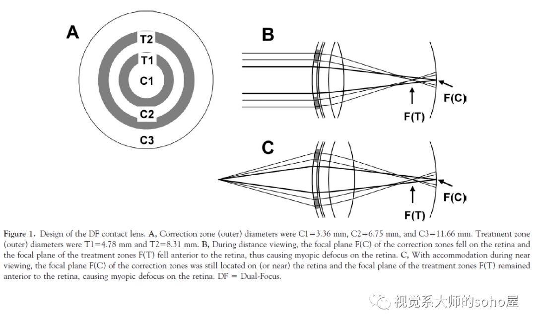 硬性隐形眼镜更适合超高度近视,高度近视最适合的透明隐形眼镜