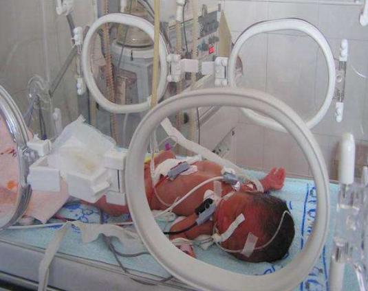 七个月就出生的早产儿该放弃吗,孕几周早产儿可以存活