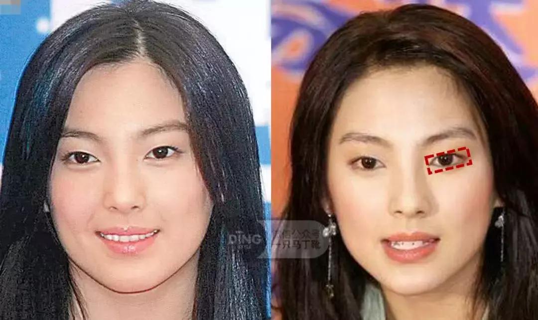 张雨绮杨丞琳对比,张雨绮眼型分析