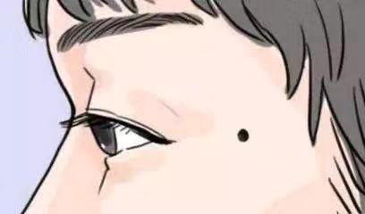 你身上的红痣是祸还是福,黑痣有多大几率变成黑色素瘤