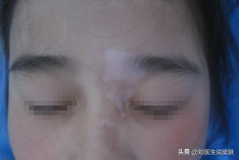 28岁女子相亲失败三次,女子相亲多次都宣告失败